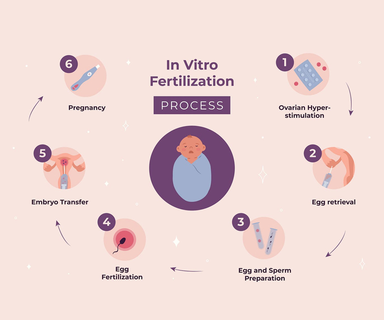 IVF Myths and Reality