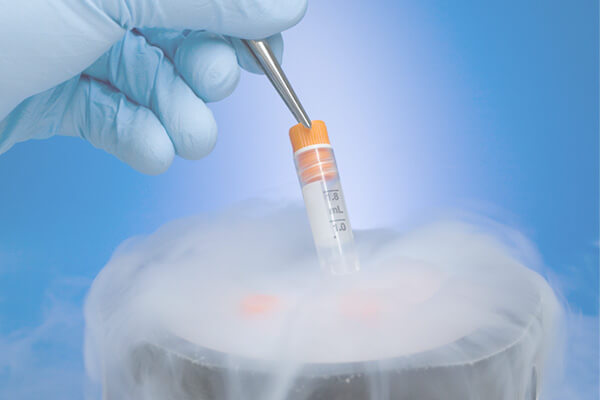 Top IVF Centre in Chandigarh